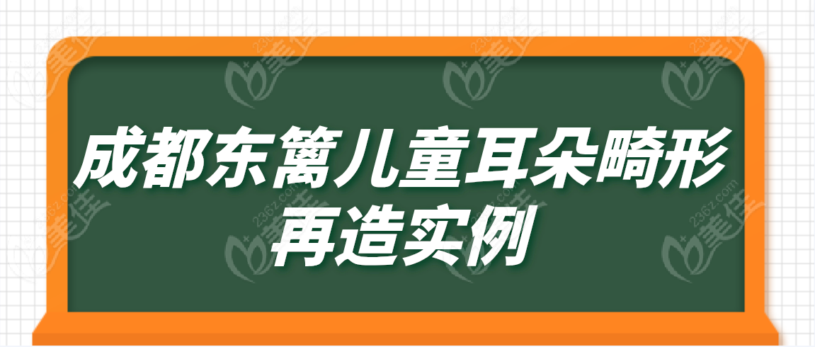 成都东篱儿童耳朵畸形再造真人实例