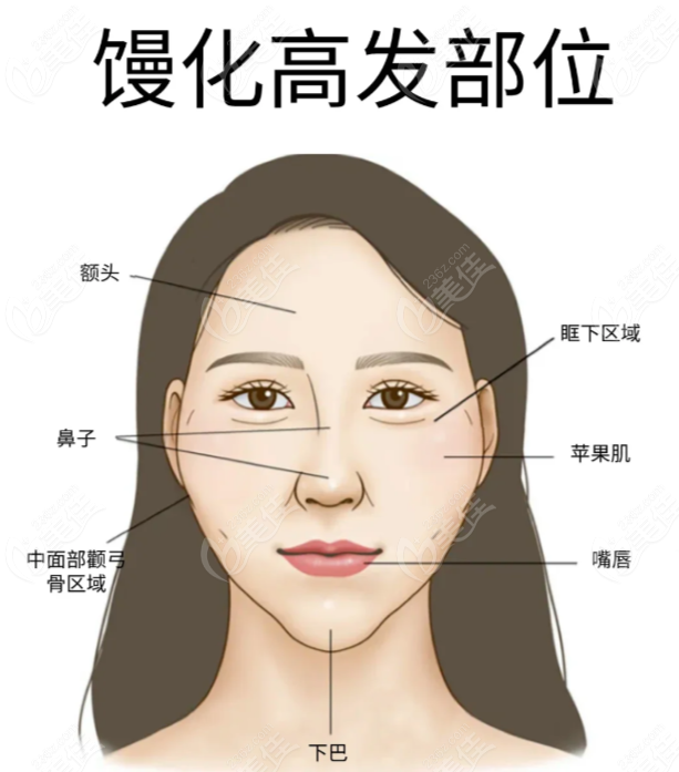 上海面部馒化修复医院排名