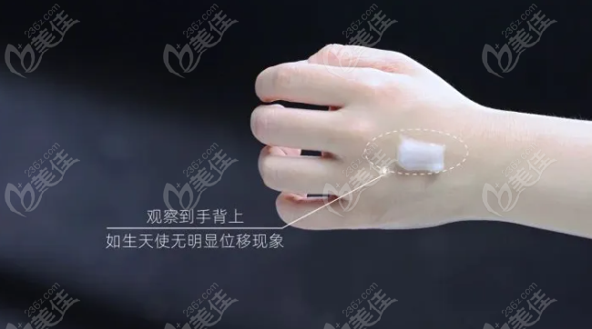 如生天使注射后基本不会位移