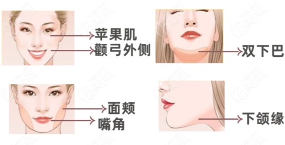 钻石超塑一次成效对比图