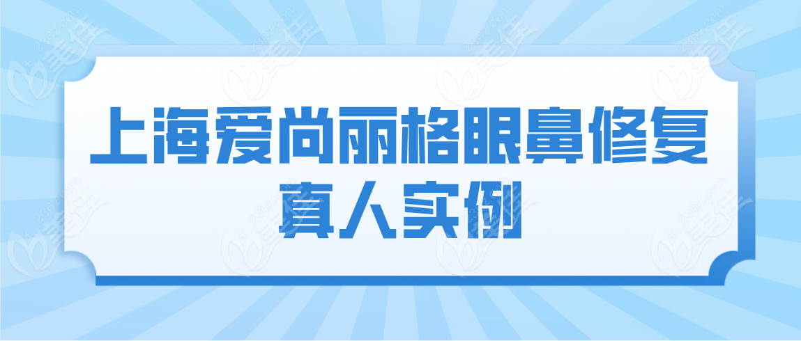 上海爱尚丽格眼鼻修复真人实例