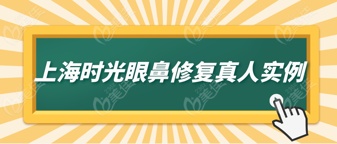 上海时光眼鼻修复真人实例