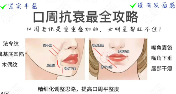 口周年轻化抗衰的具体部位