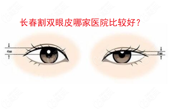 长春割双眼皮哪家医院比较好