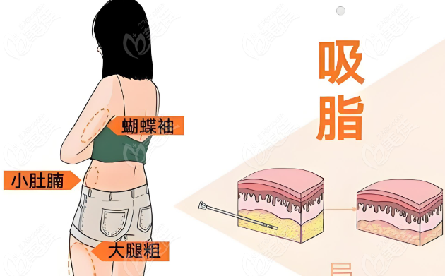重慶銅雀臺(tái)馮牧夷吸脂手法熟練收費(fèi)不貴