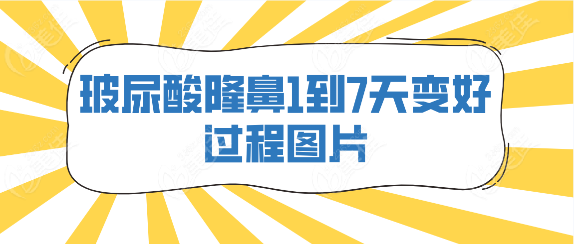 玻尿酸隆鼻1到7天變好過程圖片