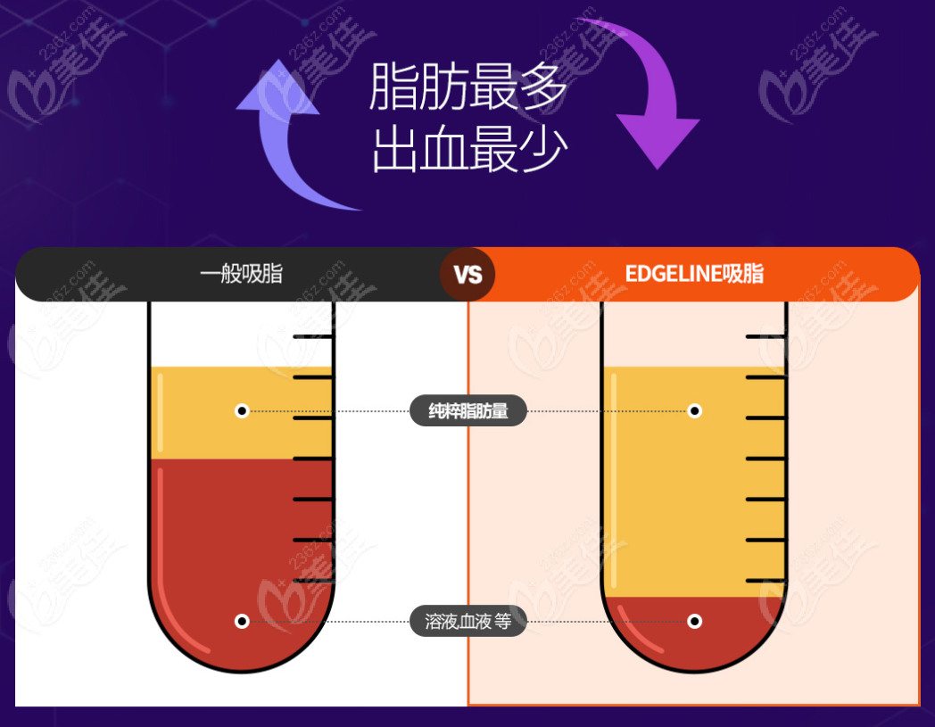 韩国爱起来整形医院吸脂技术优势