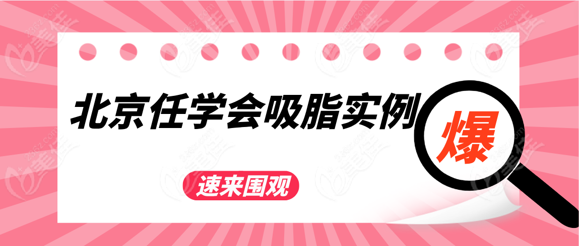 北京任學(xué)會(huì)吸脂實(shí)例