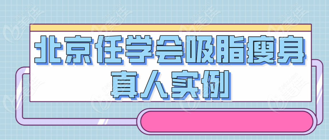 北京任學(xué)會(huì)吸脂瘦身真人實(shí)例
