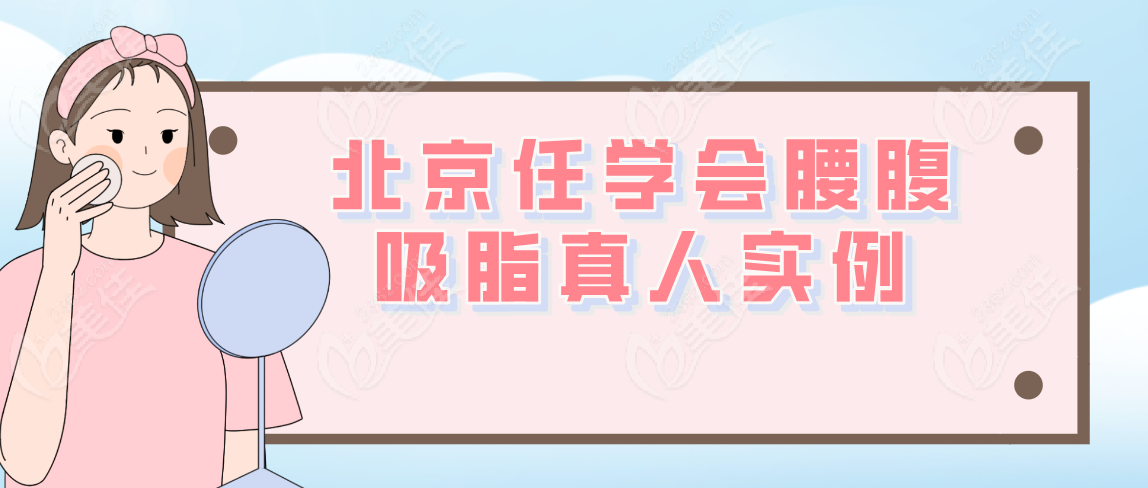 北京任學(xué)會(huì)腰腹吸脂真人實(shí)例