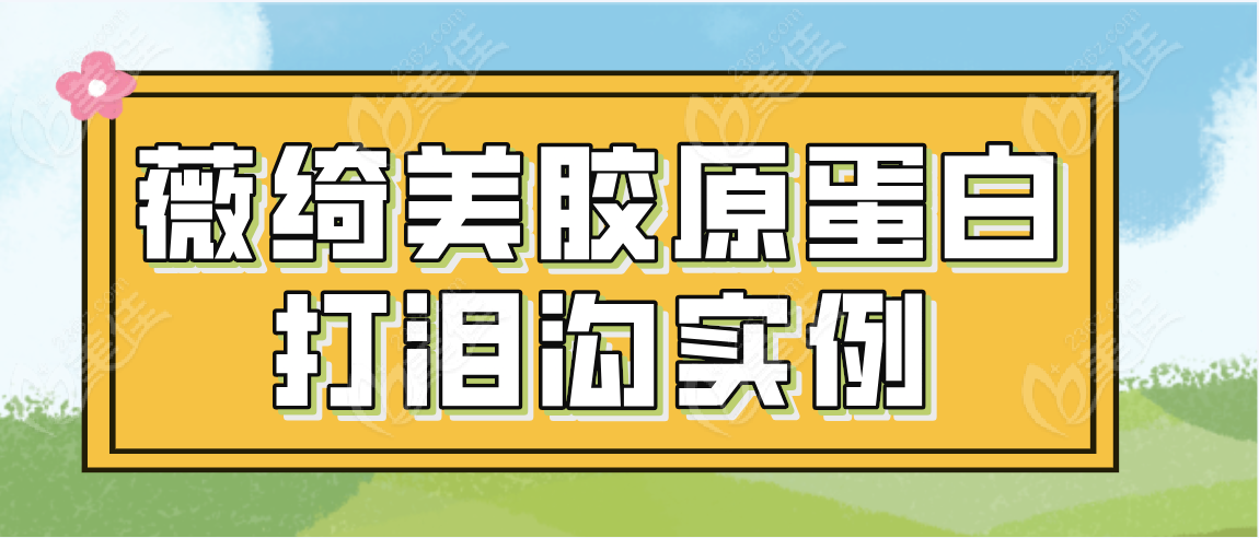 薇绮美胶原蛋白打泪沟真人实例