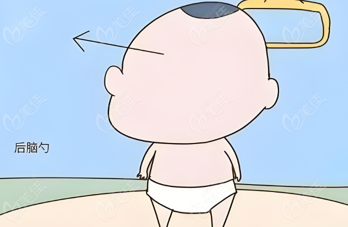 韩国后脑勺整形真实实例分享美佳网