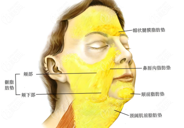 面部脂肪分布