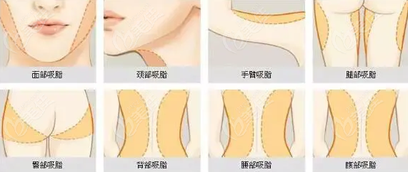 抽脂冯牧夷医生简介