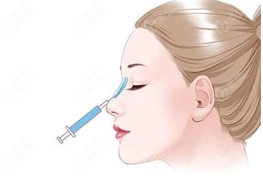  思伊美玻尿酸可靠嗎?是我國認(rèn)可的品牌很靠譜,填充鼻子輪廓定位都好用  美佳網(wǎng)