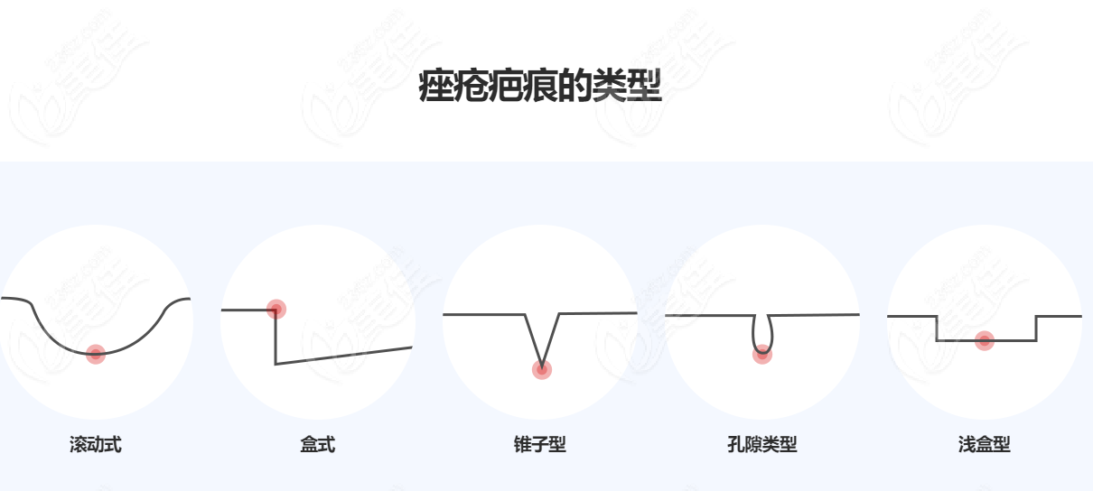 疤痕類型部分展示 疤痕類型部分展示