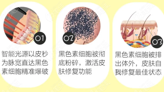 当代整形做皮秒祛斑技术好