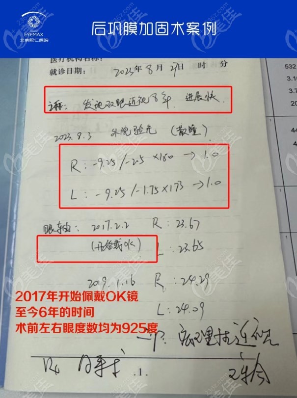 王乐今医生为15岁双眼近视900度+孩子做的后巩膜加固手术，术后近视度数稳定