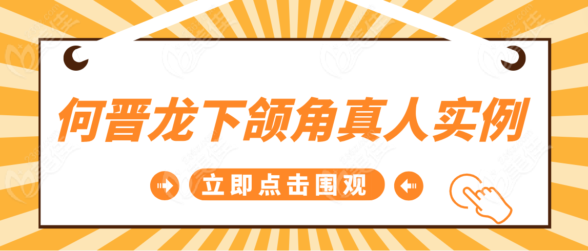 何晋龙下颌角真人实例分享