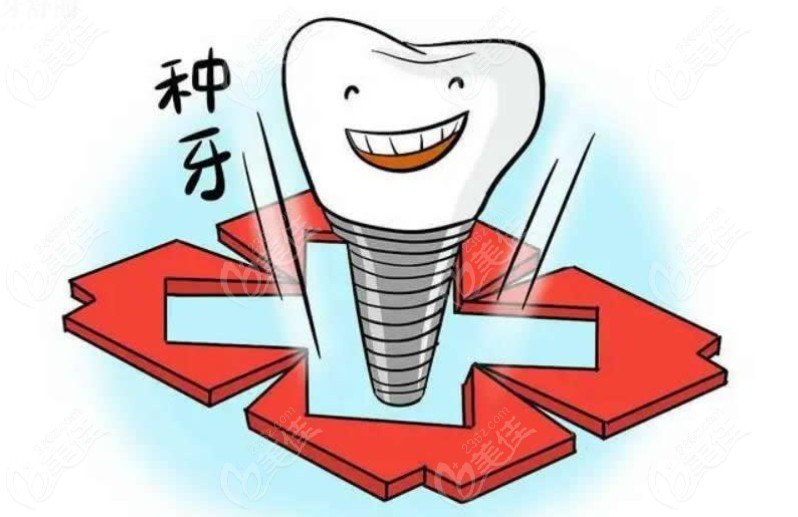 成都免费种牙可在布莱梅|新桥口腔申请领取