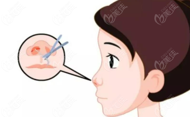 韩国MoodOn整形外科开展项目