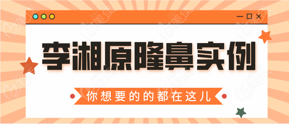 李湘原隆鼻实例分享