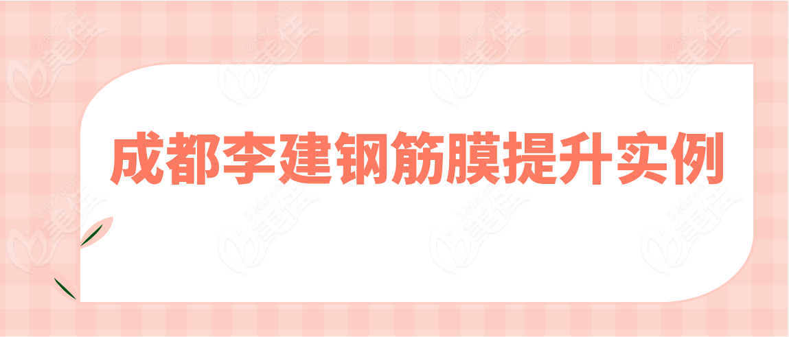 成都李建钢筋膜提升没有失败实例