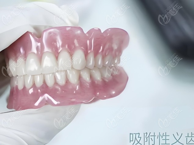 BPS全口吸附性义齿