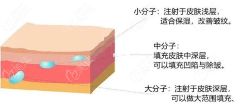 菲林娃娃针