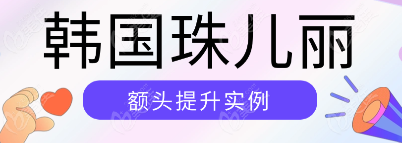 韩国珠儿丽额头提升实例解析:权映勋做额头提升术成效好,术后几乎无手术痕迹