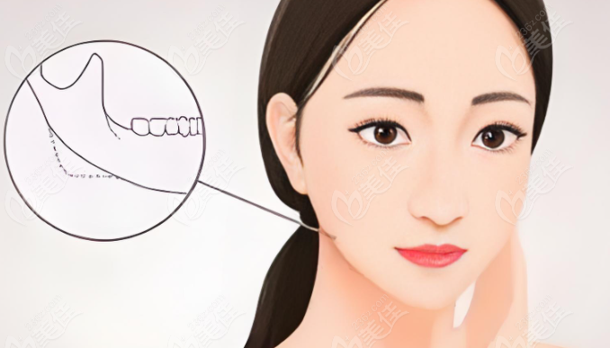 高俊明做磨骨手術(shù)失敗修復(fù)不夸張:風(fēng)格自然 高俊明做磨骨手術(shù)失敗修復(fù)不夸張:風(fēng)格自然