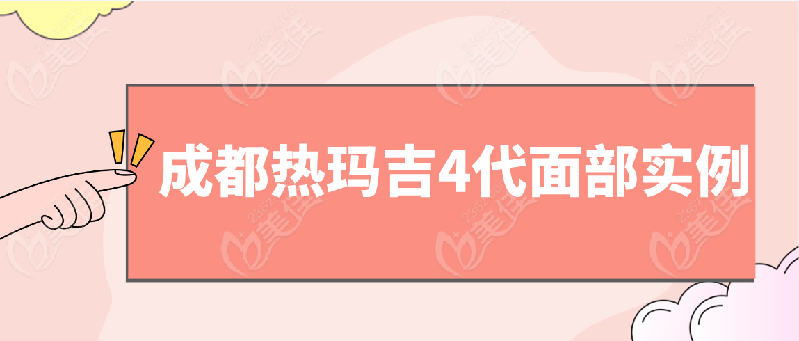 成都热玛吉4代面部提升真人实例分享