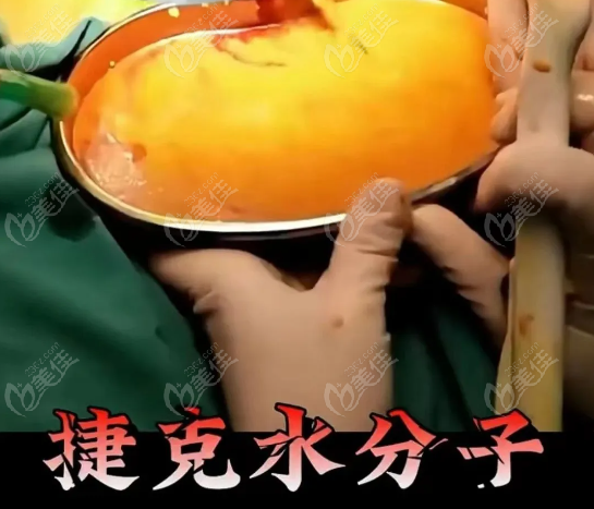 捷克水分子注射隆胸要手术取出