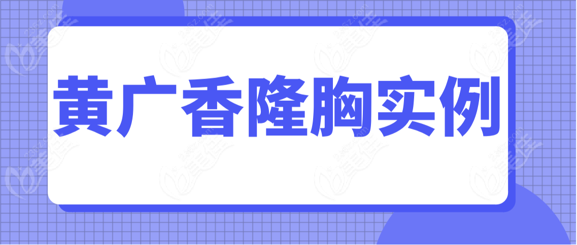 黄广香隆胸实例