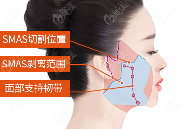 韩国初见医院拉皮怎么样?使用小切口拉皮,面部紧致度更好(附地址)