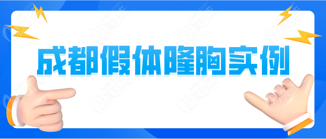 成都假体隆胸实例分享