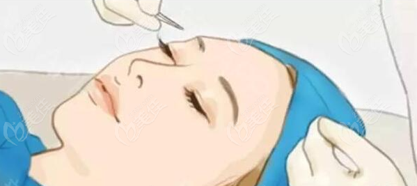 m.23美@佳6z.co/m成都中银海医美何军怎么样?真实事例证明何生做双眼皮真的牛