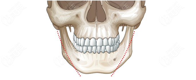 韓國(guó)明星star整形外科高法旻術(shù)前照片1