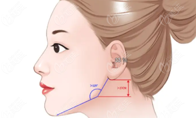 韓國(guó)Star整形做下頜角手術(shù)實(shí)例風(fēng)格自然