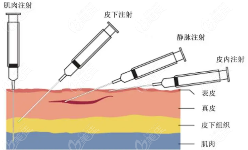 236z.com玻尿酸注射