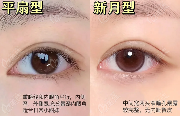 杨丽美颜医疗美容割双眼皮怎么样