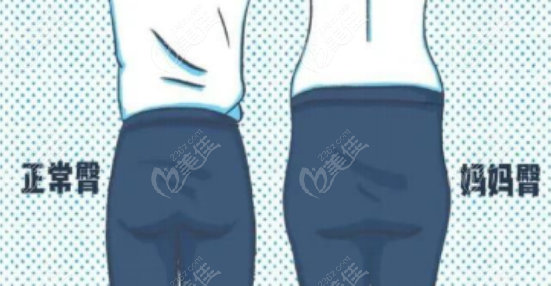 妈妈臀成因