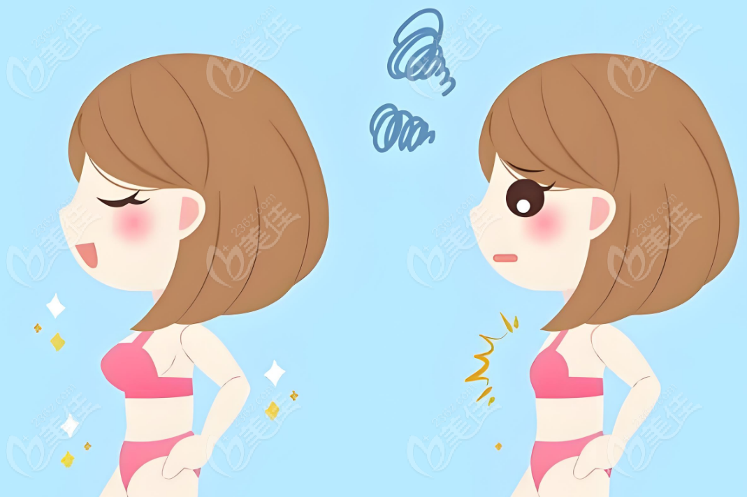 栗勇縮胸手術(shù)成功的女生真實(shí)反饋