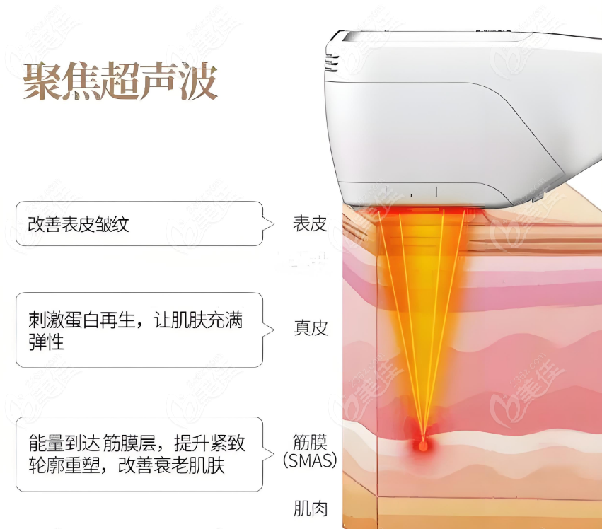 兰州超声炮价格