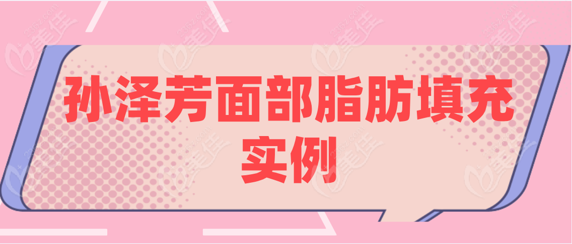 孙泽芳面部脂肪填充实例分享