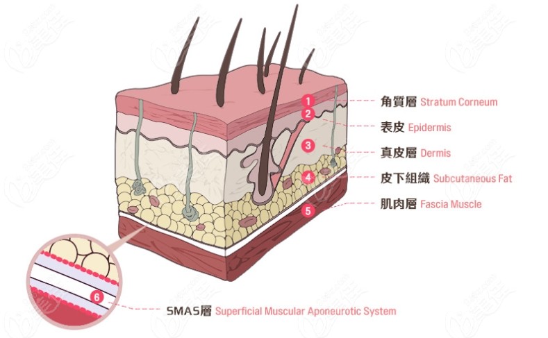 金泰宪医生做拉皮是深入到SMAS层的www.236z.com