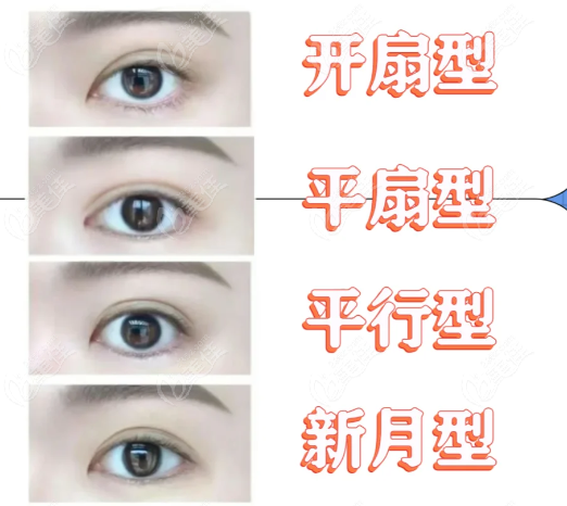 西安郑小红医生口碑怎么样