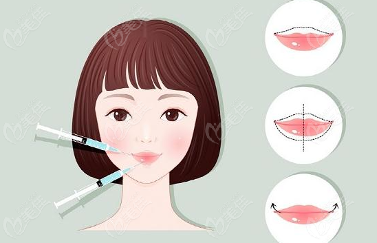 杭州豐唇崔晶瑩怎么樣?杭州維多利亞崔晶瑩打造嘟嘟唇飽滿自然可沖!
