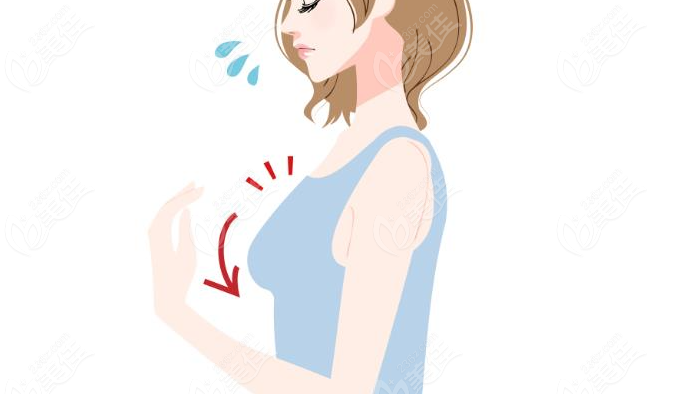 俞國寶醫生乳房下垂矯正技術口碑好
