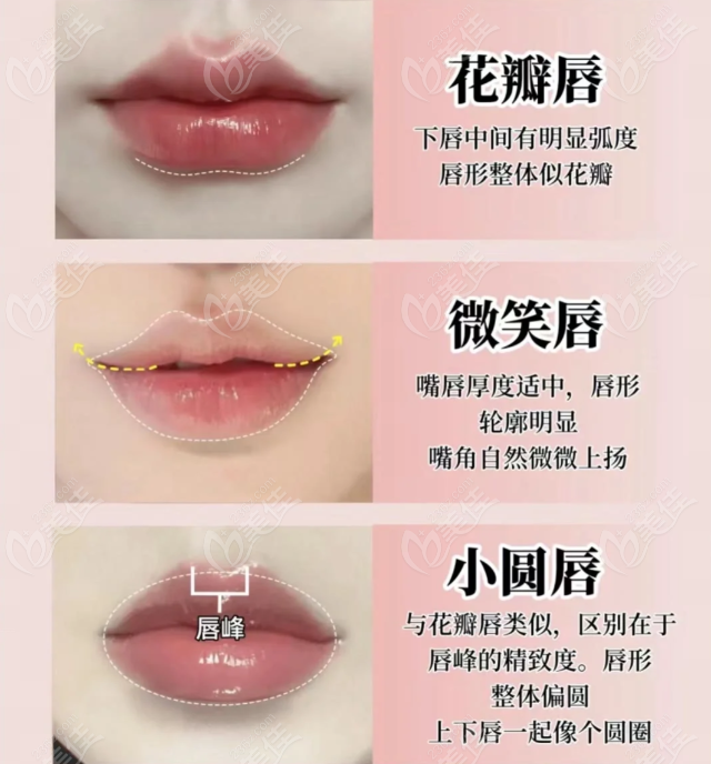 嘴唇整形手术